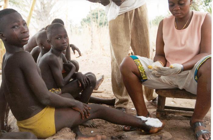 A crying girl named Akouma from the Dofelgou District of Northern Togo getting a Guinea worm removed. A crying girl named Akouma from the Dofelgou District of Northern Togo getting a Guinea worm removed.