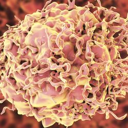 Colon Cancer Cell
