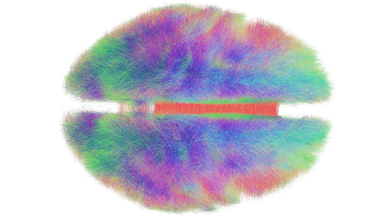 the human connectome