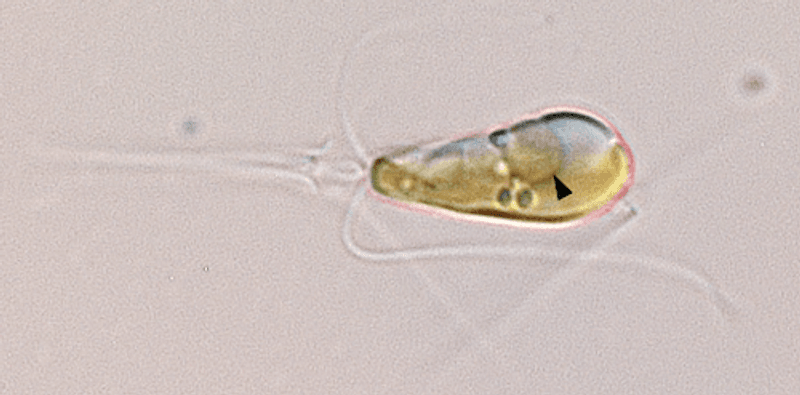 A light microscopy image shows the marine haptophyte algae Braarudosphaera bigelowii with a black arrow pointing to the nitroplast organelle